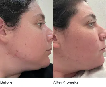 Sydney before after.