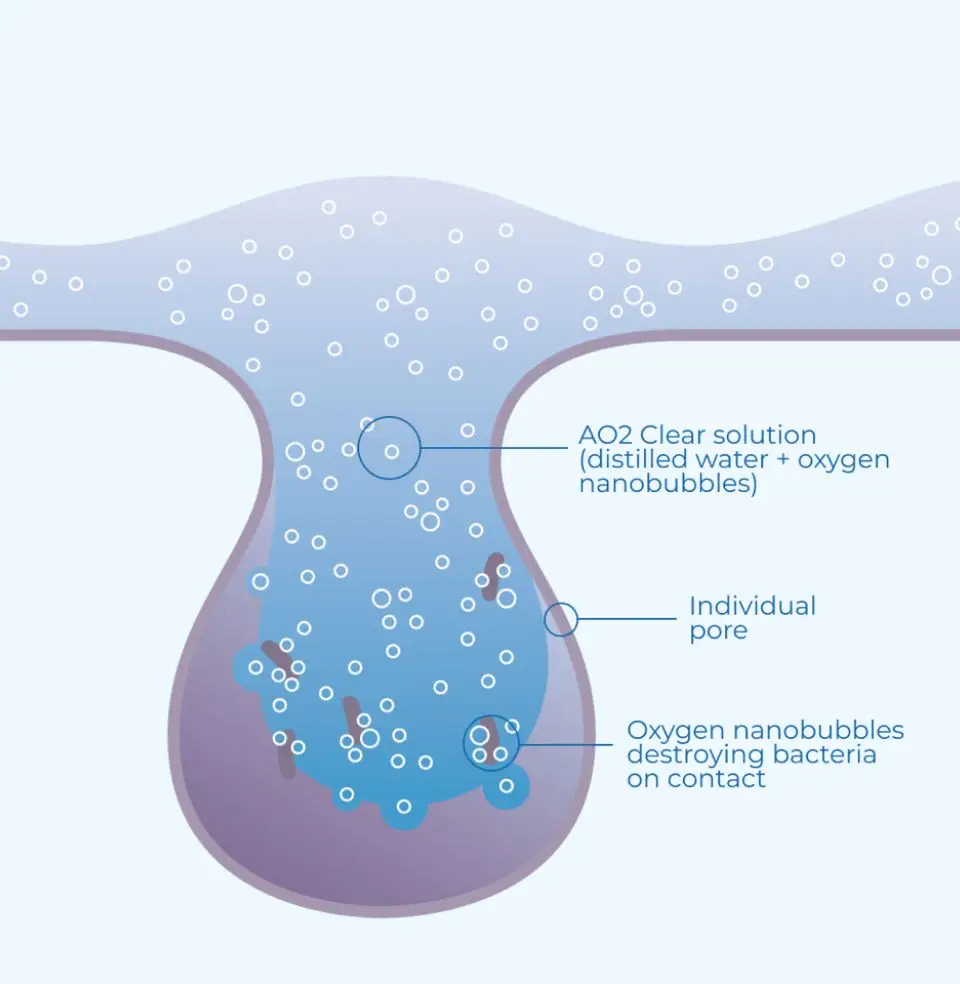 Pores with AO2Clear interactive with bacteria